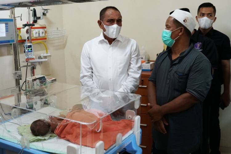 Edy Rahmayadi Kunjungi Bayi Kembar Siam Dempet Perut dari Asahan