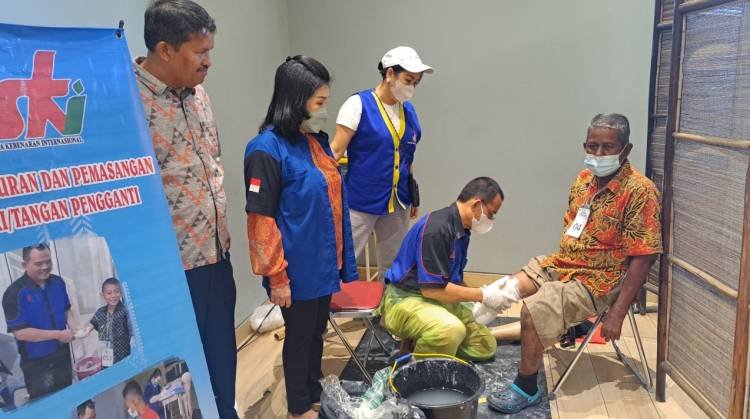 Bakti Sosial, YSKI Salurkan Kaki dan Tangan Palsu di Medan