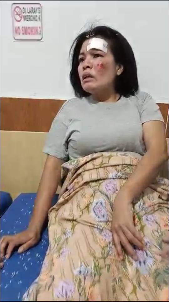 Seorang PNS di Kodam I/BB Terluka Usai Dirampok Bandit Jalanan