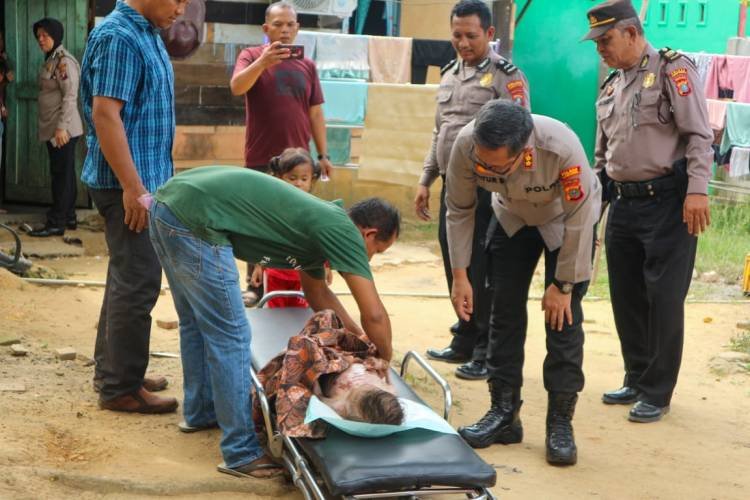 Respon Cepat Kapolres Labusel, Bantu Pengobatan Balita Menderita Sakit Menahun