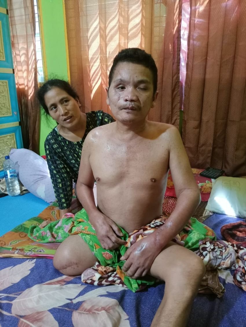 Korban Cacat Permanen, PBH Peradi Medan Minta Polresta Deliserdang Tahan Tersangka Kasus Lakalantas
