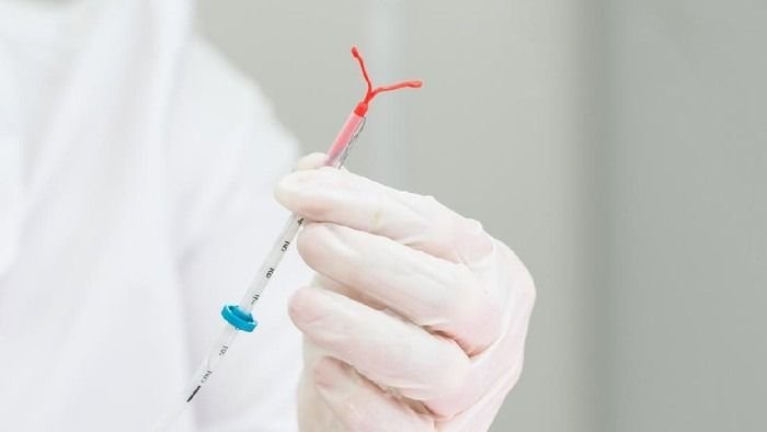 KB IUD Disebut Picu Kanker Payudara, Apa Kata Ahli ?