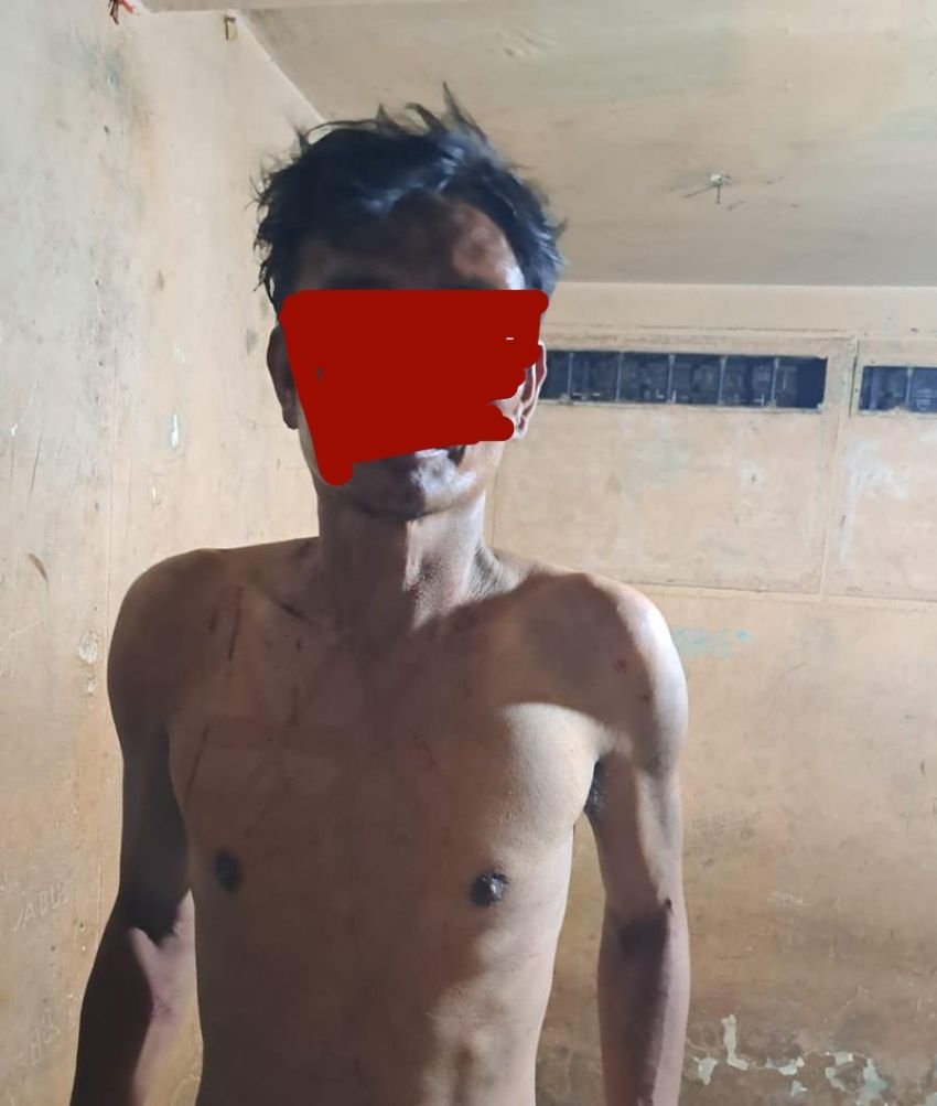 Berusaha Bunuh Ibu Kandungnya karena Tak Diberi Uang, Seorang Pria Diamankan Polsek Medan Area