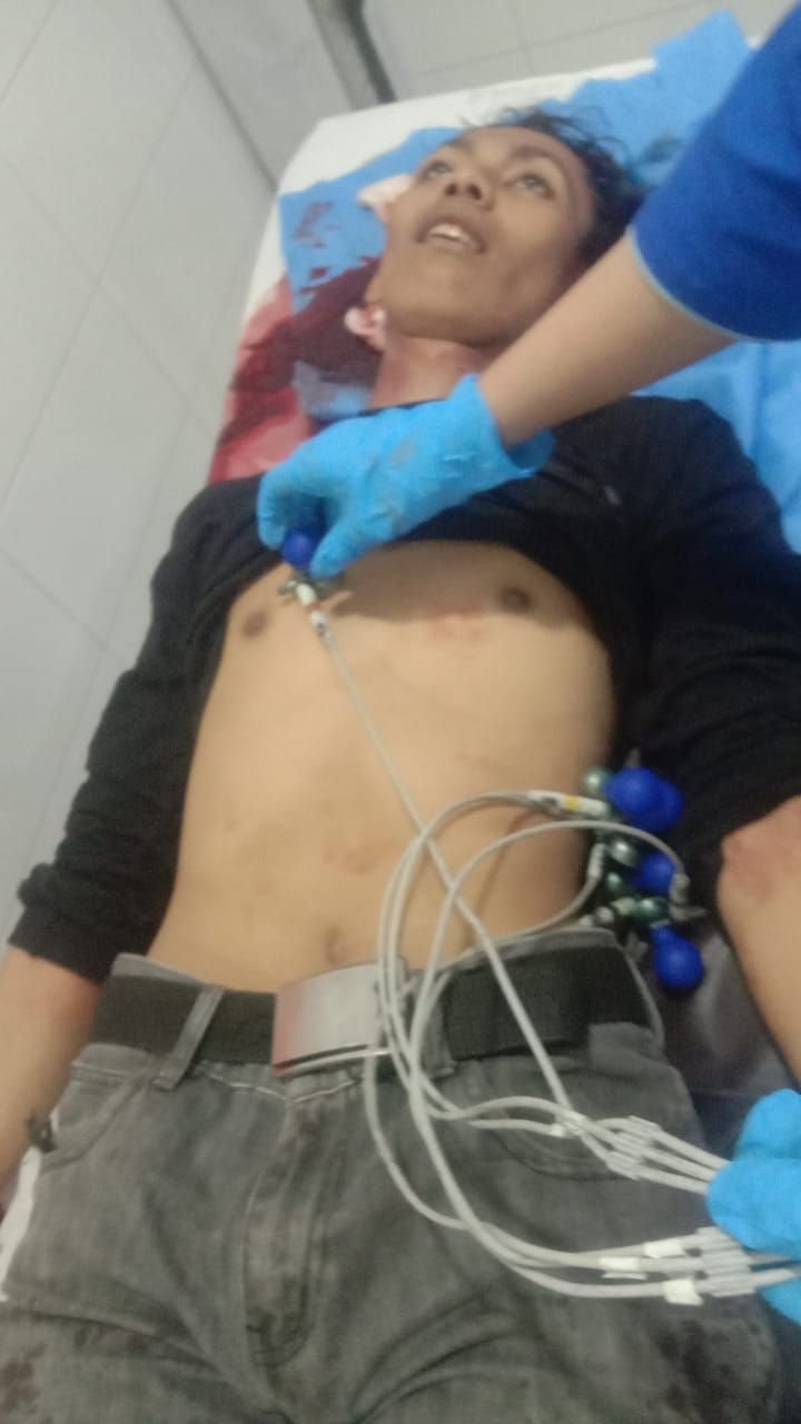 Diduga Korban Tawuran, Seorang Pria di Medan Deli Tewas Dianiaya