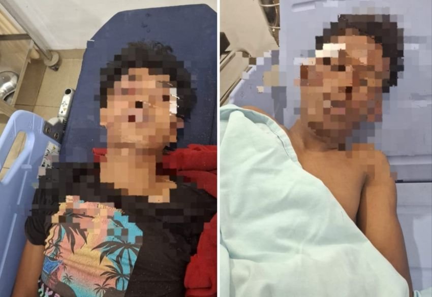 Polisi Jaga Ketat 2 Pelaku Jambret Tewaskan Seorang Wanita di Pematangsiantar